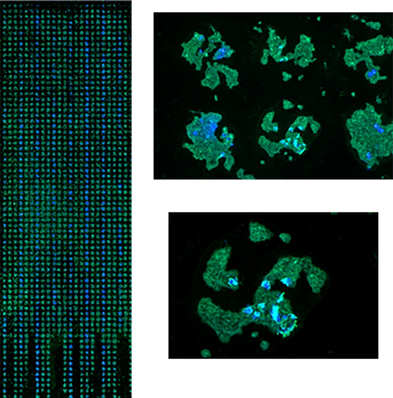 Cell Microarrays 2 Whole slide CMA scanning scanned at 0.5μm pixel size.