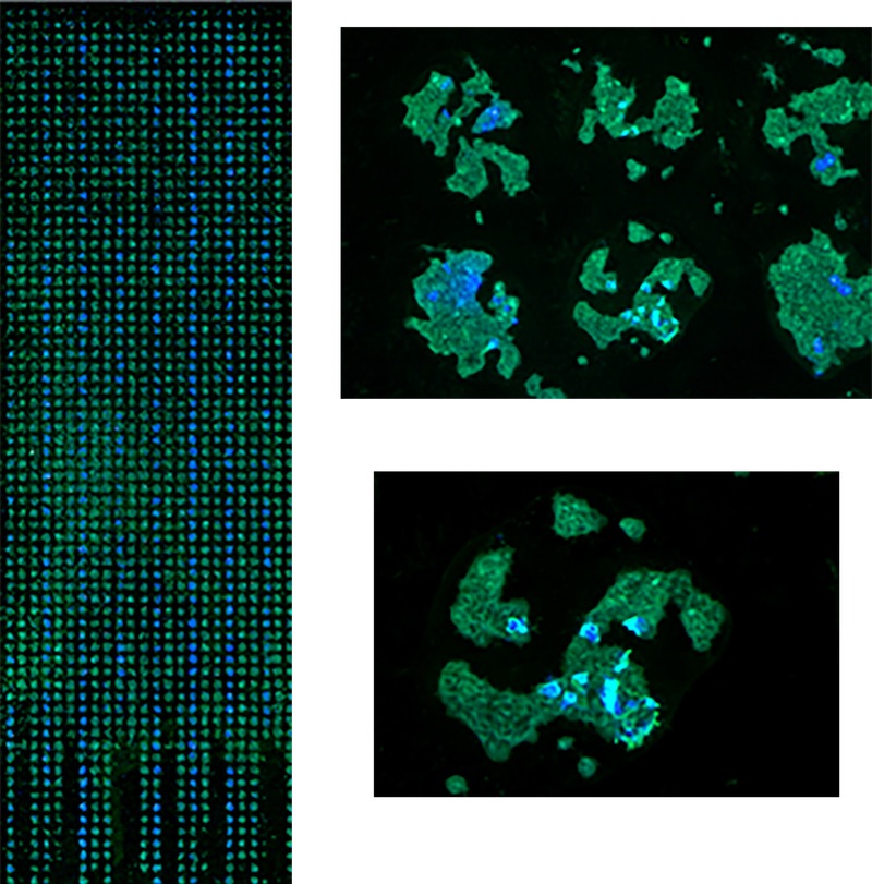 Whole slide CMA scanning scanned at 0.5μm pixel size.