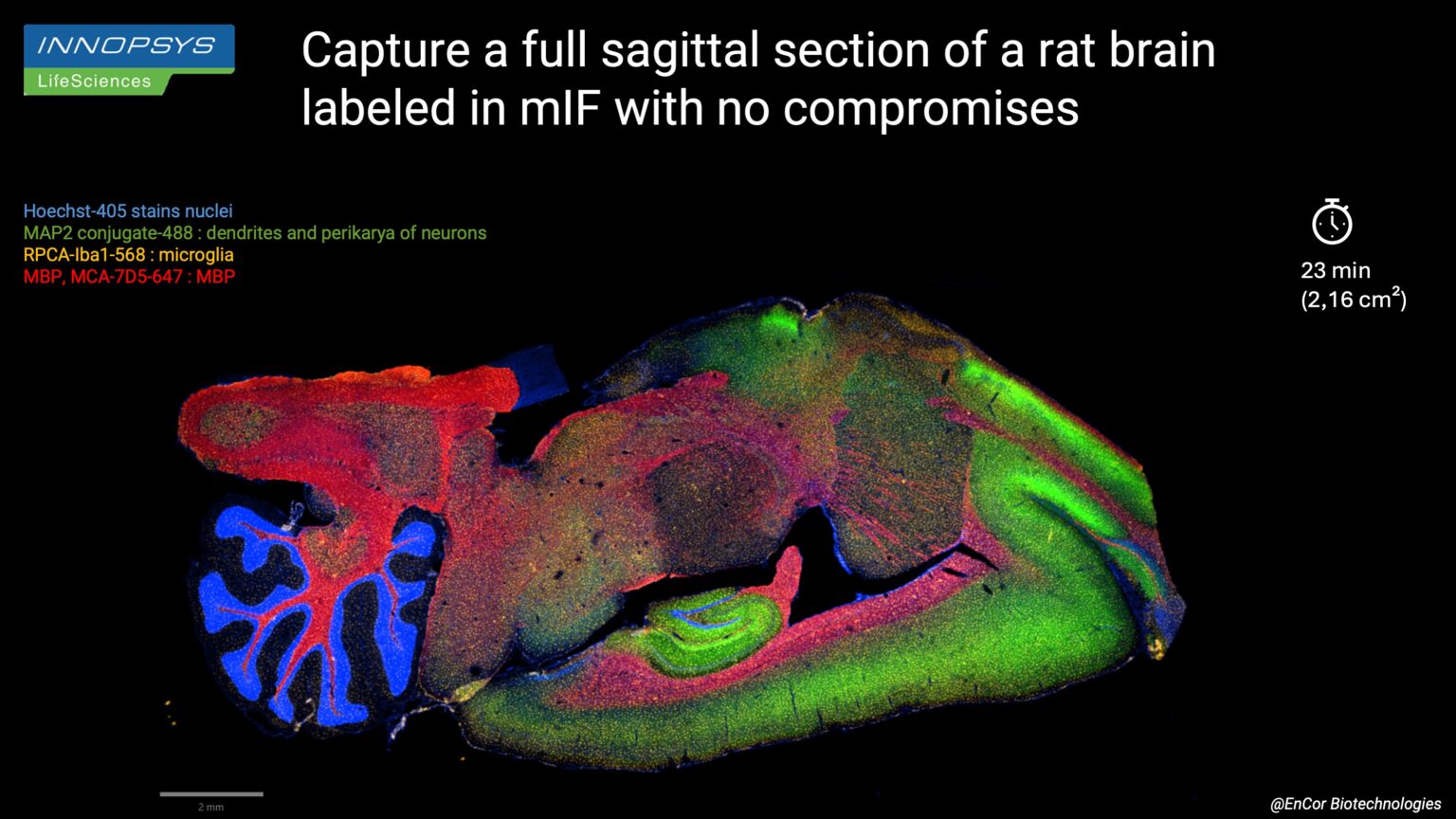 Diapositive11