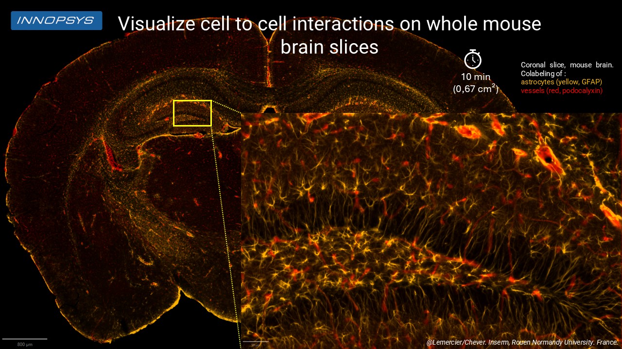 Mouse Podocalyxin Oana