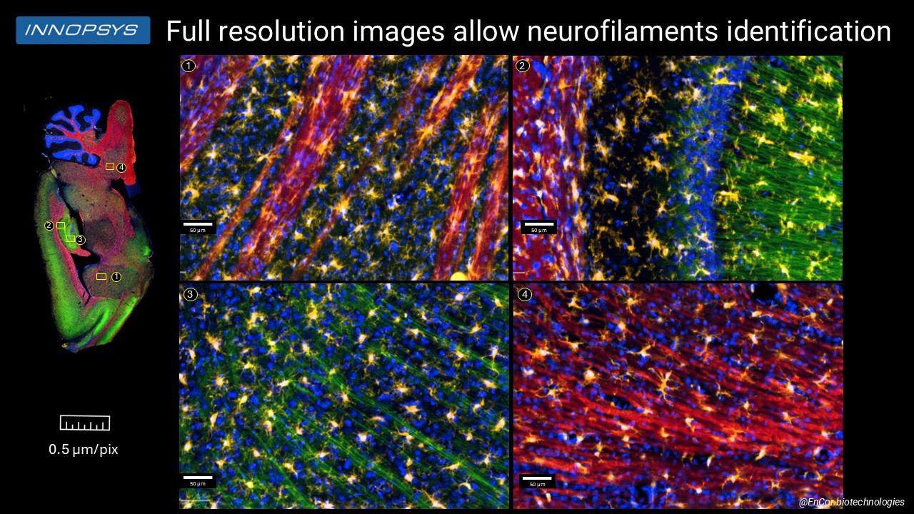 Neurofilaments EnCor