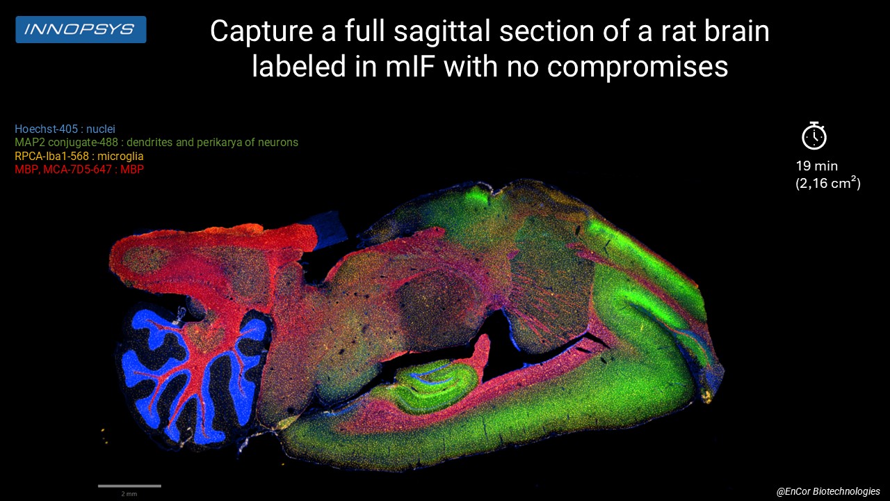 Rat Sagittal Brain Encor