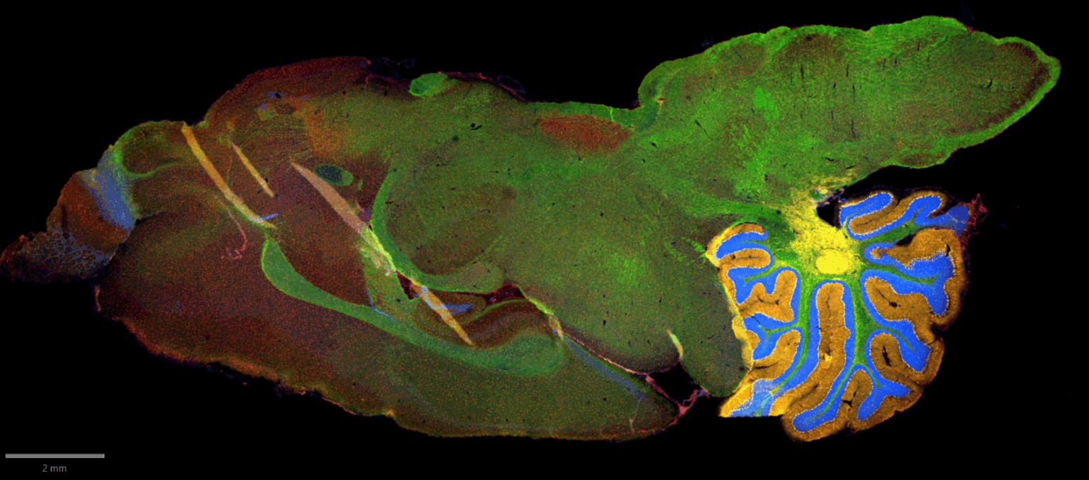 fluorescence rat brain Fluorescent slide scanner InnoQuant