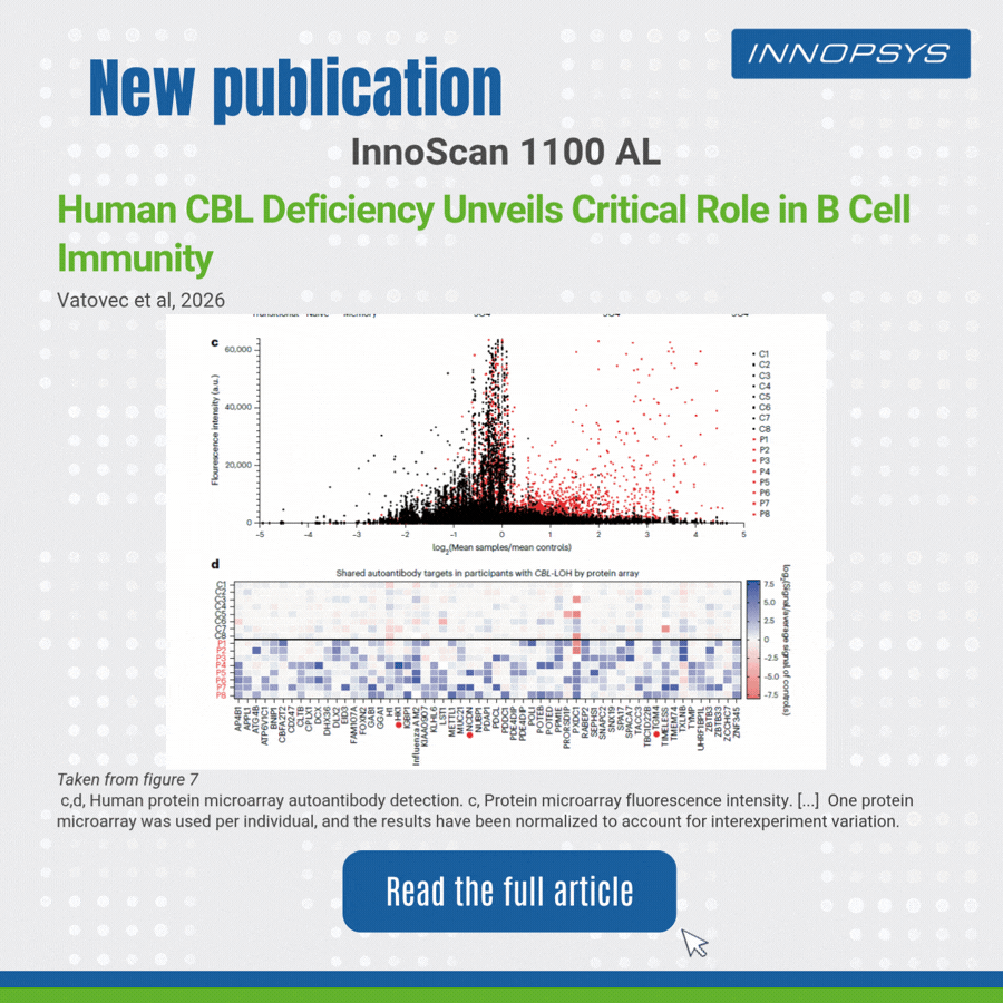 Human CBL Deficiency Unveils Critical Role in B Cell Immunity