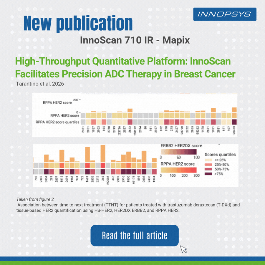 Precision ADC Therapy in Breast Cancer