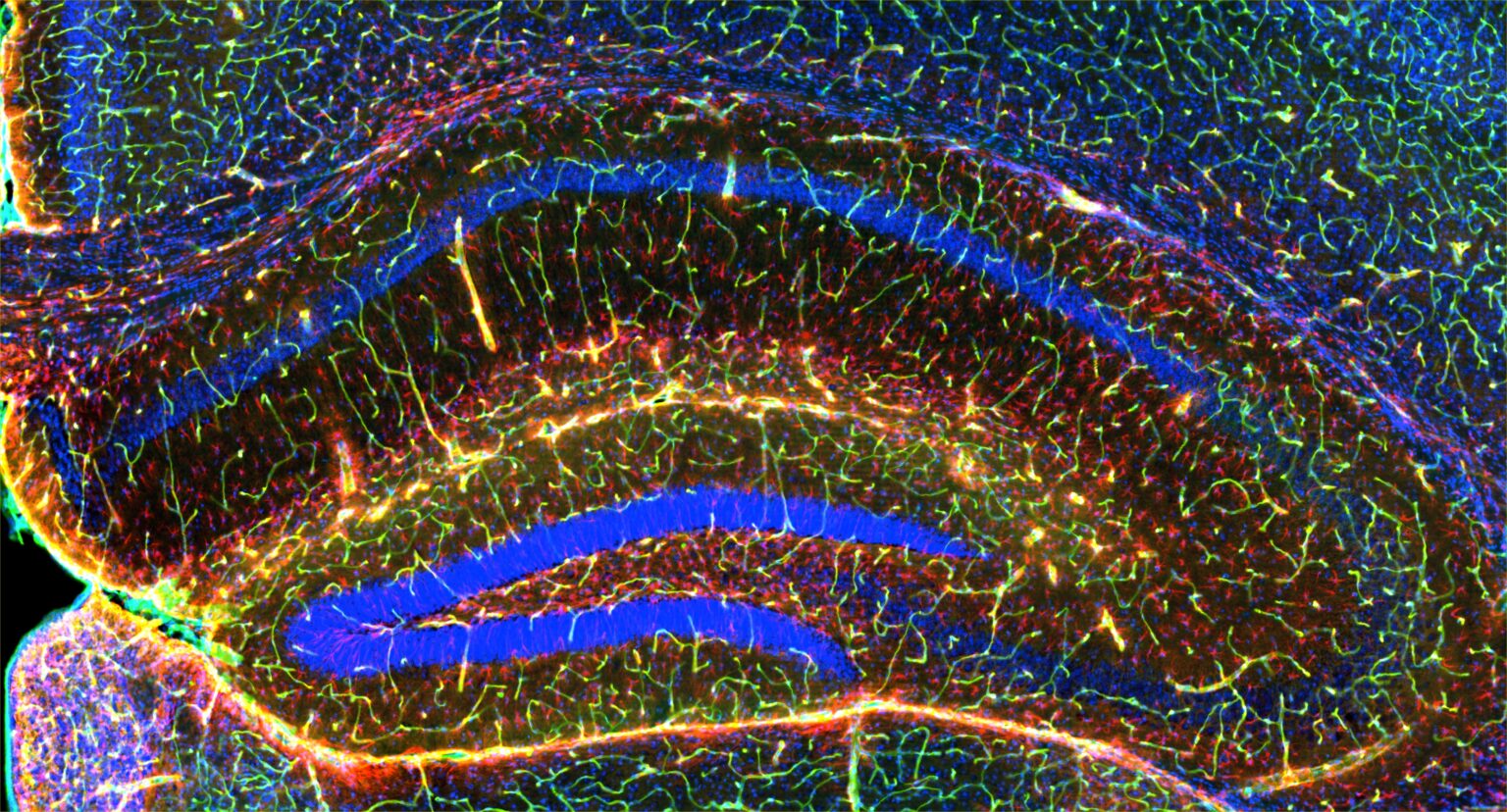 Hippocampus