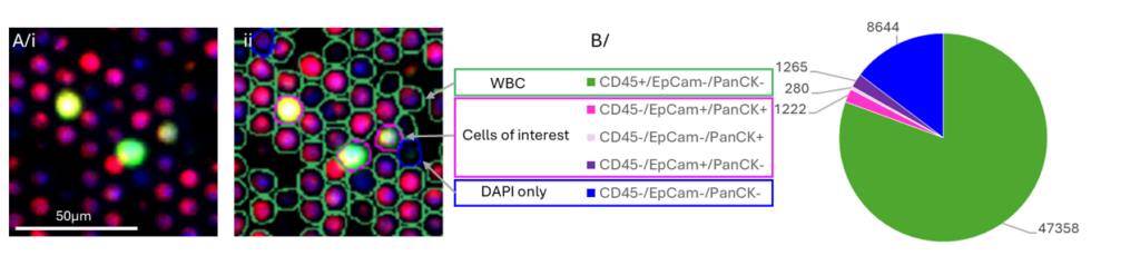 Figure 3: Zoom-in area of A/i original image and ii/ image with pre-classification applied, from the same example filter as Figure 1. B/ Repartition of pre-classified objects