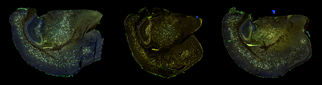 amyloid plaques lysosomal alterations FAD mouse