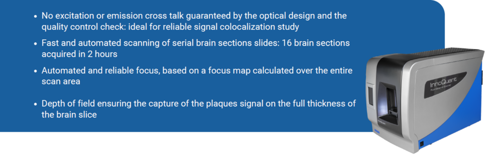 amyloid plaques lysosomal alterations FAD mouse
