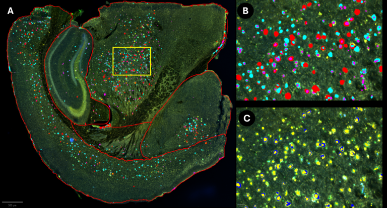 amyloid plaques lysosomal alterations FAD mouse